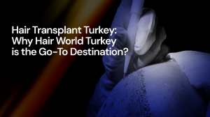 Hair Transplant Turkey: Why Hair World Turkey is the Go-To Destination? Hair Transplant Turkey: Why Hair World Turkey is the Go-To Destination?